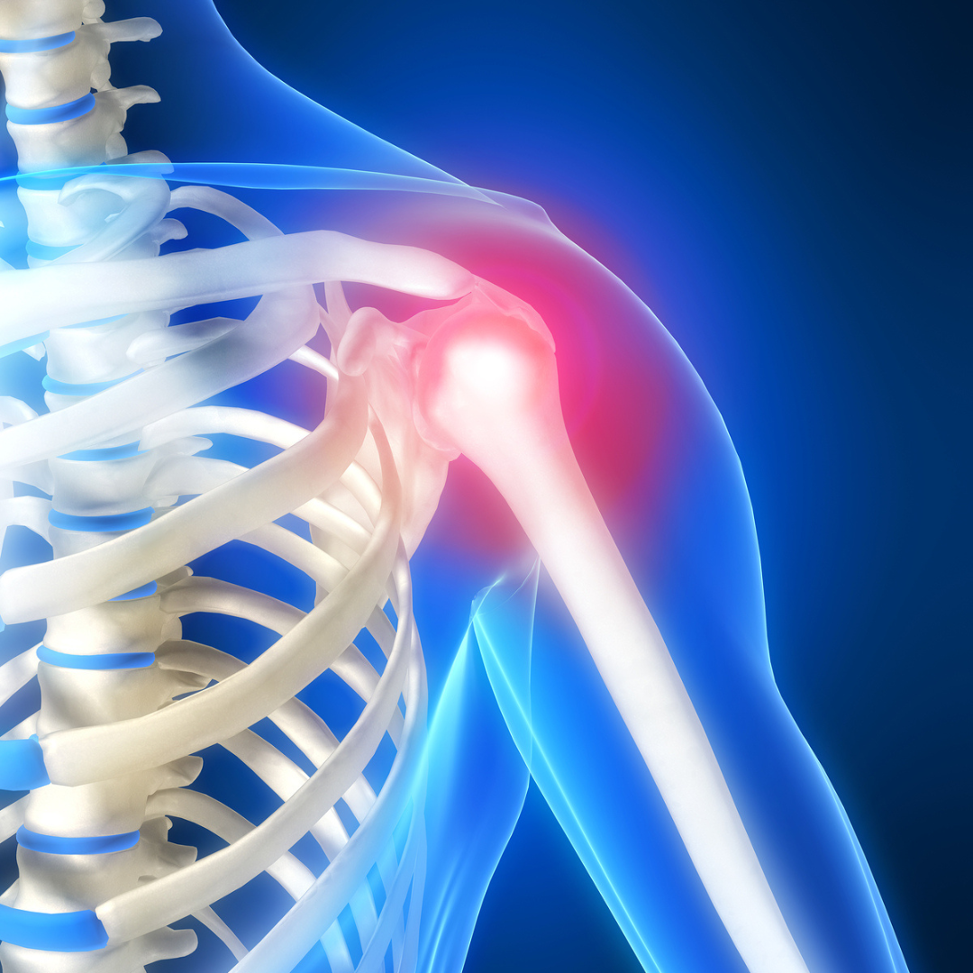 Having Total Shoulder Replacement Surgery? Here’s What You Need to Know: A Q&A with Dr. Justin Khoriaty