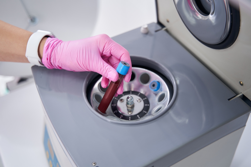 PRP blood centrifugation process