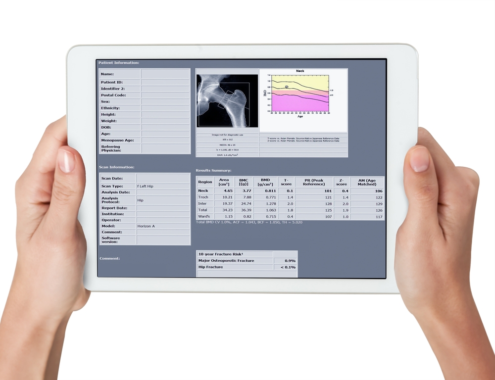 example of DXA body comp scan results