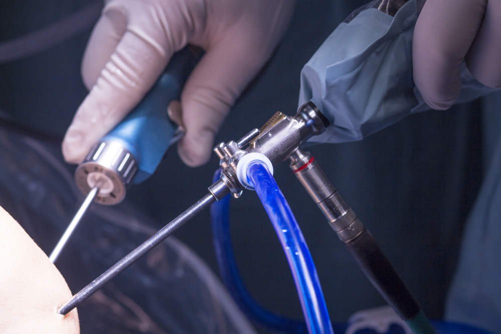 innovative tools allow orthopedic surgeons to perform minimally invasive surgeries