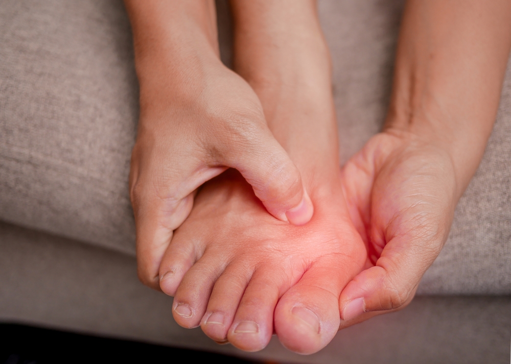 Close-up of a foot with a visible bunion on the big toe, commonly treated with minimally invasive bunion surgery.