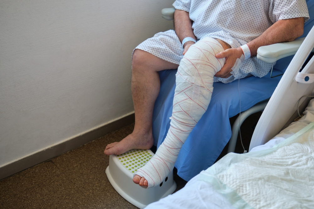 A knee replacement patient sits beside a hospital bed with their surgical leg fully wrapped in bandages and elevated on a step stool. The individual is wearing a hospital gown and appears to be in the early stages of recovery following knee replacement surgery.